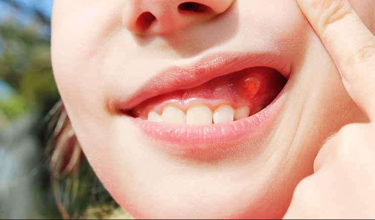 F stula Dentista Legal F stula Dentista Legal