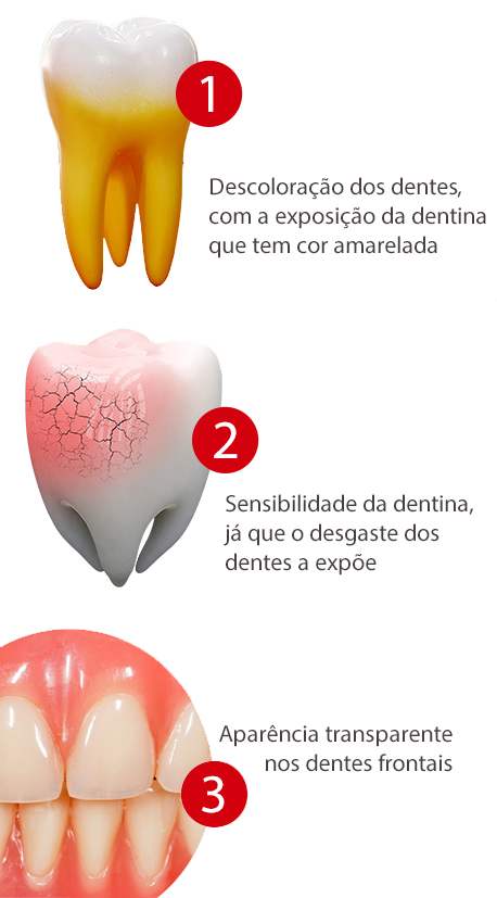 erosão dentária