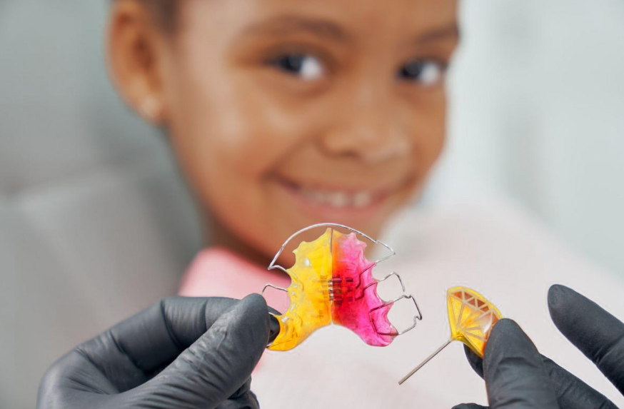 aparelho ortodontico infantil Aparelho Expansor Móvel