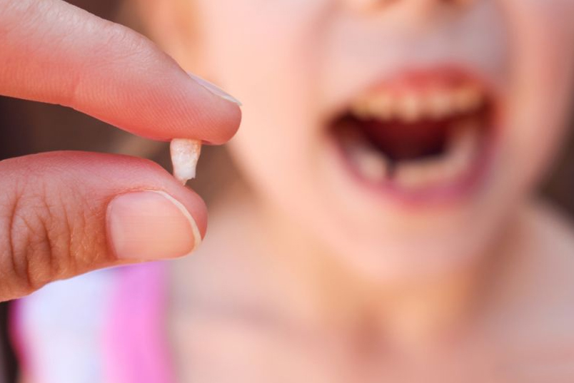 odontopediatria traumatismo dente quebrado porto alegre