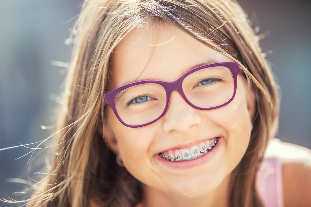 Vantagens da microabrasão dentária na infância