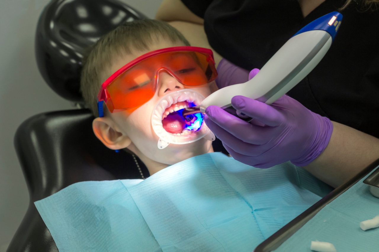 Como funciona o laser de baixa potência na odontopediatria?