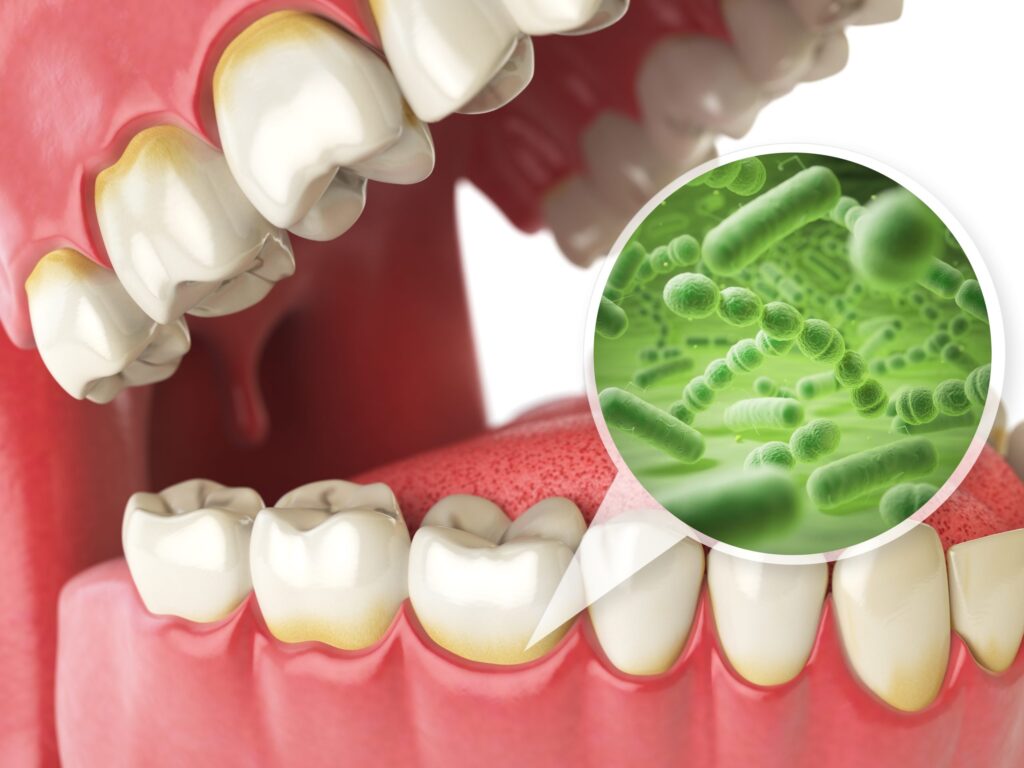 Evidenciação lúdica e remoção de placa bacteriana em crianças no consultório
